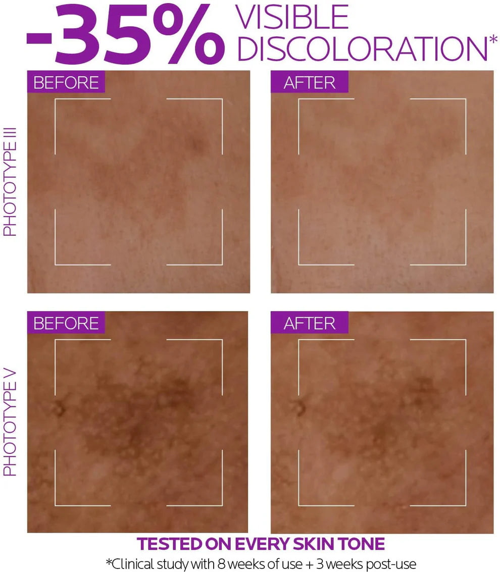 La Roche-Posay Pure Niacinamide 10 Serum – 30ml