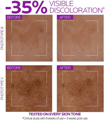 La Roche-Posay Pure Niacinamide 10 Serum – 30ml