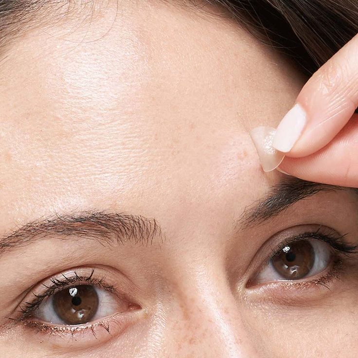 Mighty Patch™ – The Original Pimple Emergency Patch